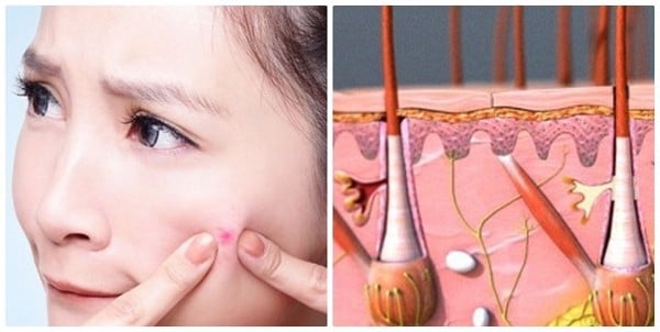 Chăm sóc da nhạy cảm bị mụn với sữa rửa mặt trà xanh - 2