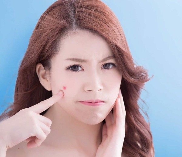 Giải đáp các thắc mắc thường gặp về viên uống trị mụn nội tiết - 2