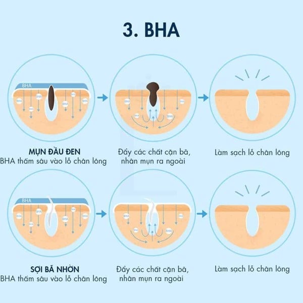 BHA tiêu diệt mụn bằng cách thấm sâu vào lỗ chân lông