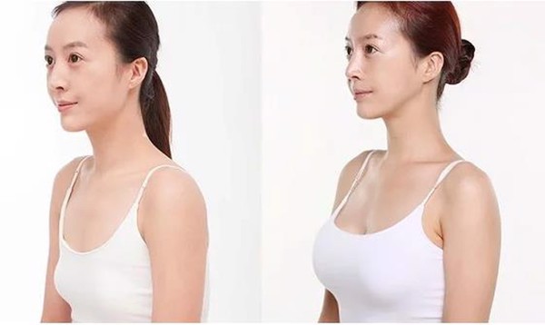 thực phẩm chức năng mầm đậu nành