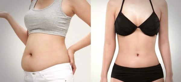 gel tan mỡ bụng