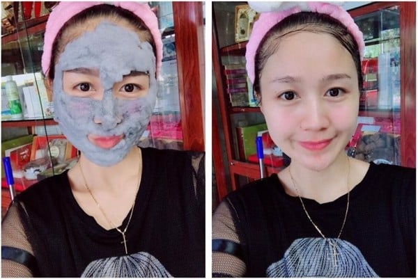 Các cách thải độc cho da mặt bạn cần biết - 1