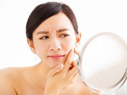 da dầu mụn ở má