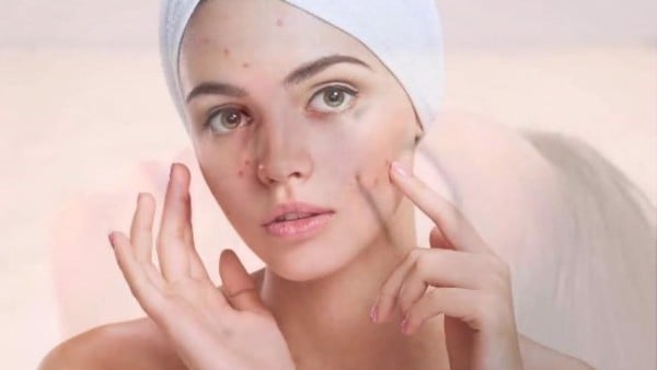 Hiểu lầm về cách sử dụng kem tẩy tế bào chết khiến da kém sắc - 3