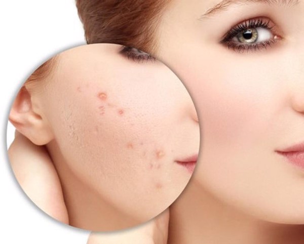 chăm sóc da bằng mặt nạ thiên nhiên