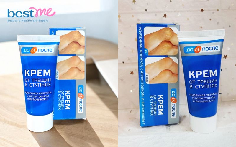 Kem dưỡng chai chân Kpem Apteka