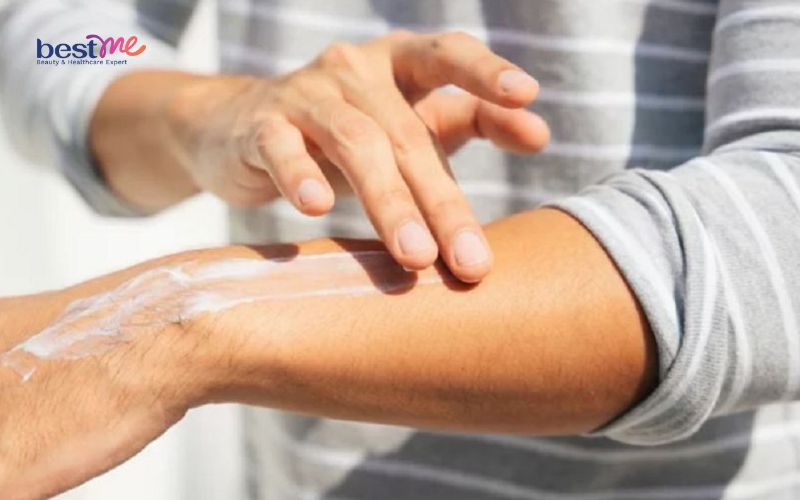 Kem chống nắng hết hạn có dùng được không? Dùng có sao không? - 3