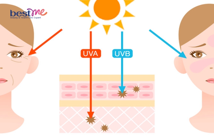 Tác hại khi không dùng kem chống nắng cho da nhạy cảm