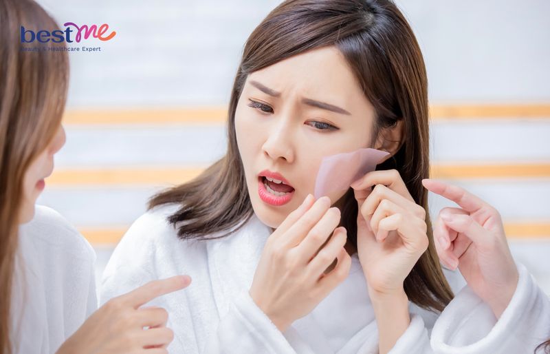 Da dầu hay còn gọi là da nhờn 