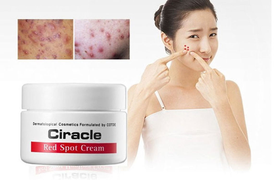 Kem Dưỡng Ciracle Red Spot Cream dưỡng ẩm và ngăn ngừa mụn hiệu quả