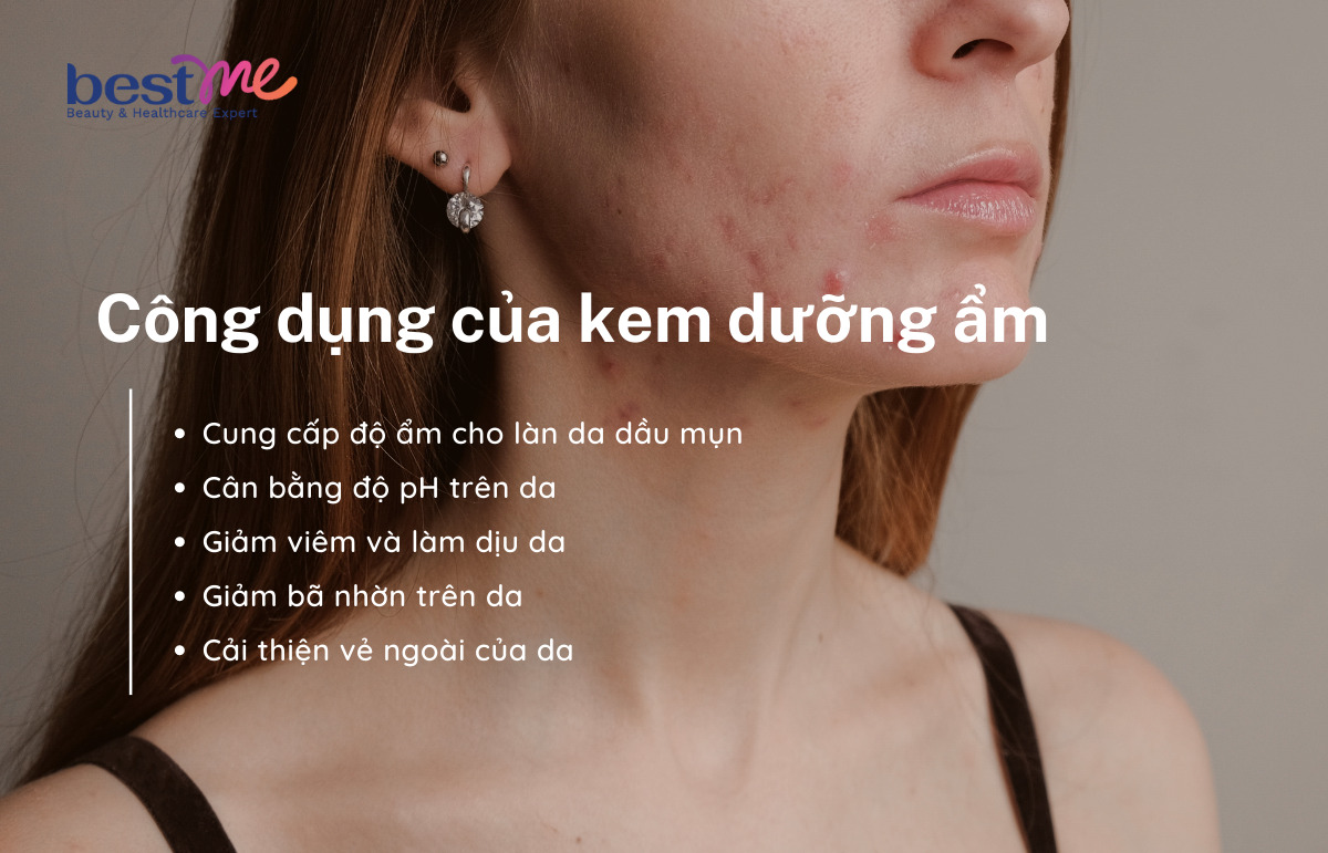 Công dụng kem dưỡng ẩm cho da dầu mụn