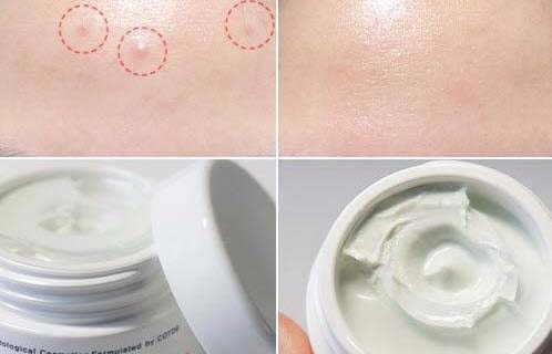 Hiệu quả sau khi sử dụng Ciracle Red Spot Cream