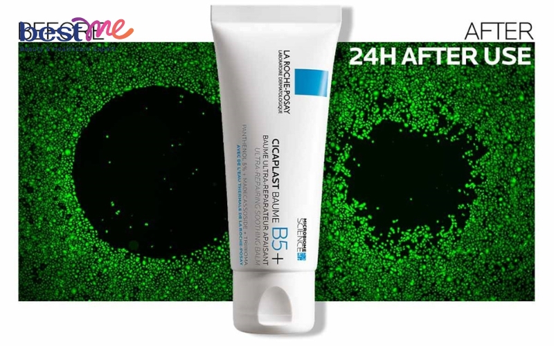 Kem phục hồi da b5 cải thiện tình trạng da chỉ sau vài ngày sử dụng