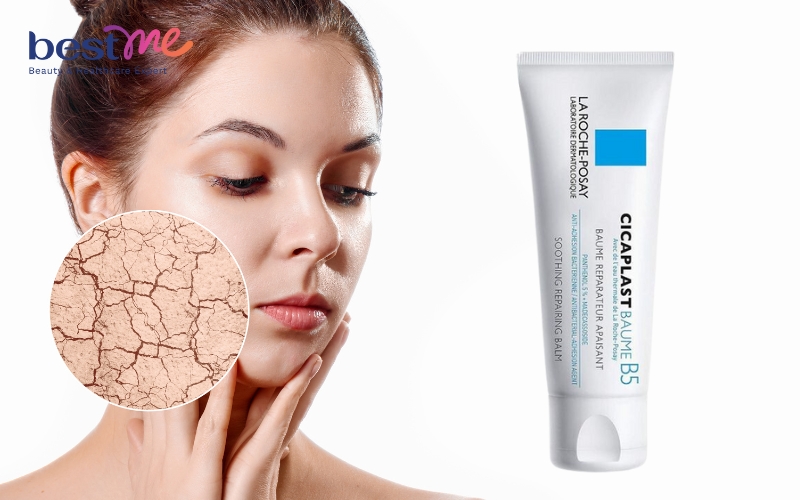 Kem phục hồi da B5 nhà La Roche-Posay cải thiện làn da tổn thương vô cùng hiệu quả