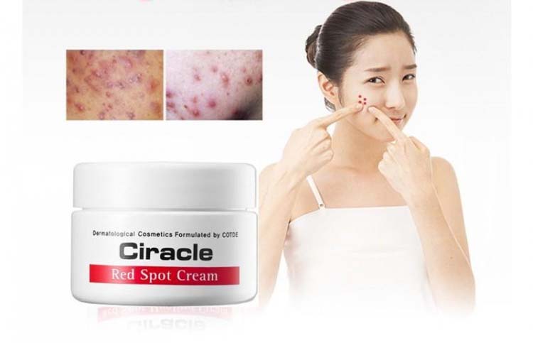 Kem dưỡng phục hồi da sau nặn mụn Ciracle Red Spot Cream