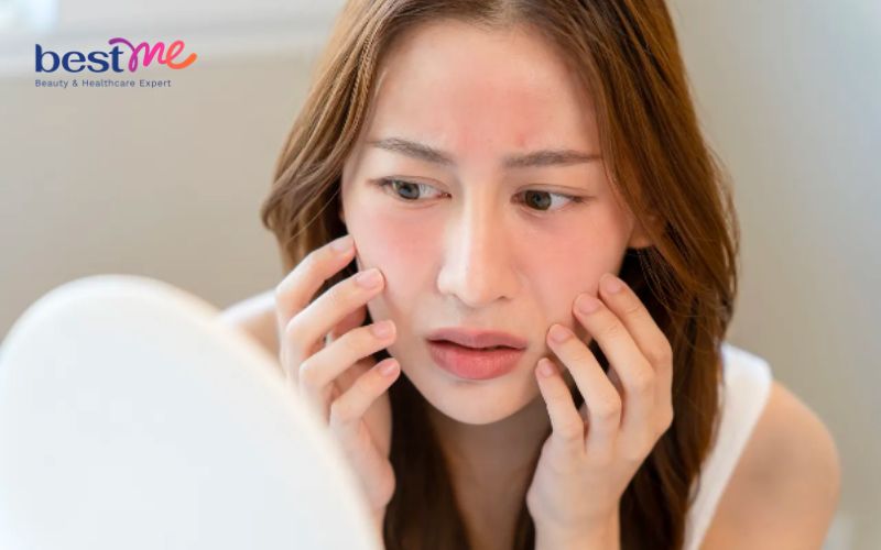 Da nhạy cảm nên chọn các loại kem tẩy tế bào chết có thành phần lành tính
