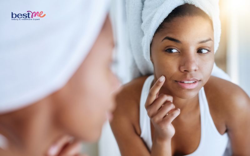 Kết hợp Niacinamide và Vitamin C được không? 6 cách tốt nhất - 5