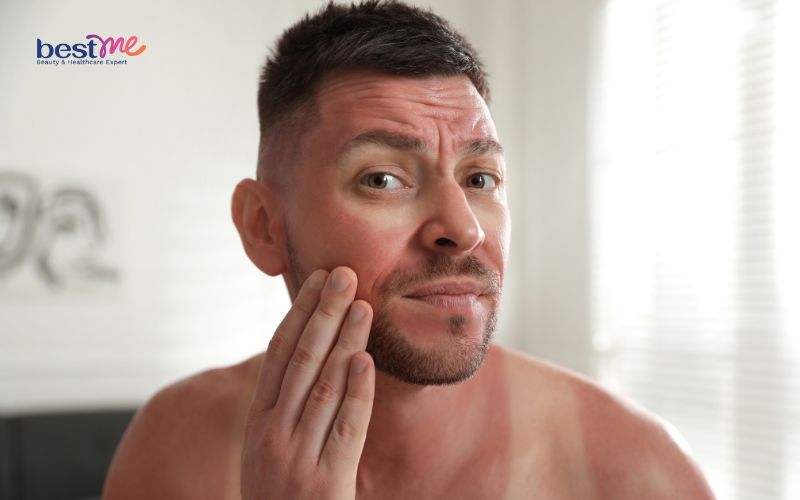 Kết hợp Niacinamide và Vitamin C được không? 6 cách tốt nhất - 6