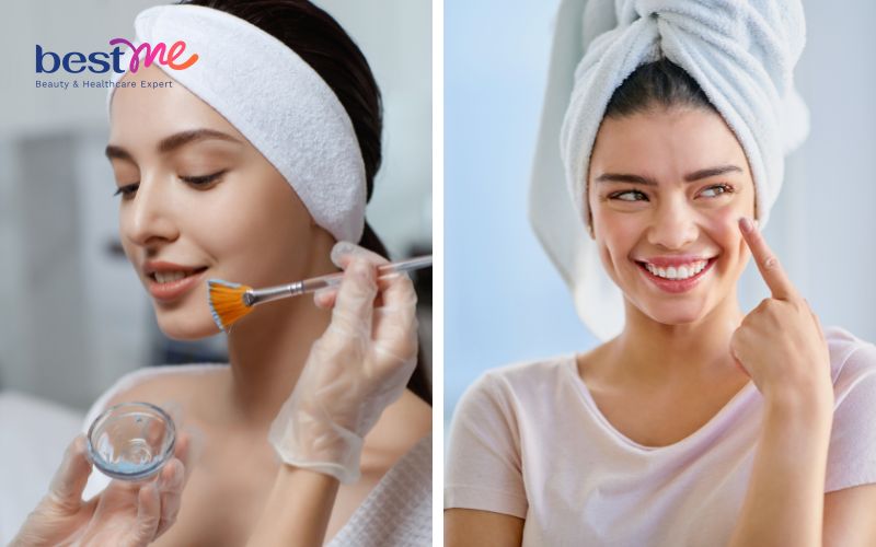 Khám phá cách trị mụn nội tiết ở cằm hiệu quả triệt để nhất - 11