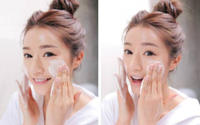 Nguyên nhân và phương pháp phục hồi da mặt bị rỗ tại nhà an toàn - 11