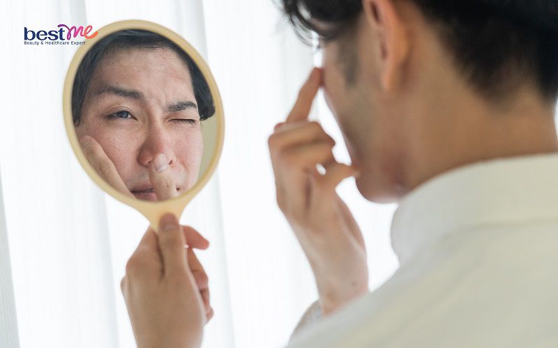 Những lợi ích mà nam giới cần biết khi làm trắng da