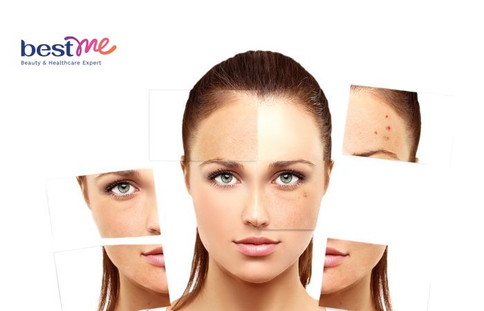 Khi mang thai làn da có nhiều sự thay đổi