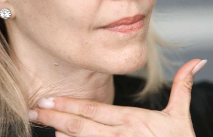 Khả năng lưu thông máu dưới da của vùng da này chậm hơn hẳn so với da mặt, lượng collagen ở da vùng cổ cũng không nhiều như ở mặt