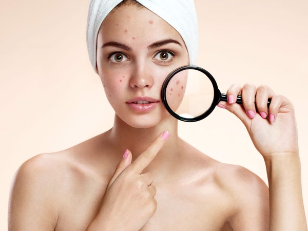 Mách nhỏ bạn gái cách chọn kem nền cho da mụn - 1