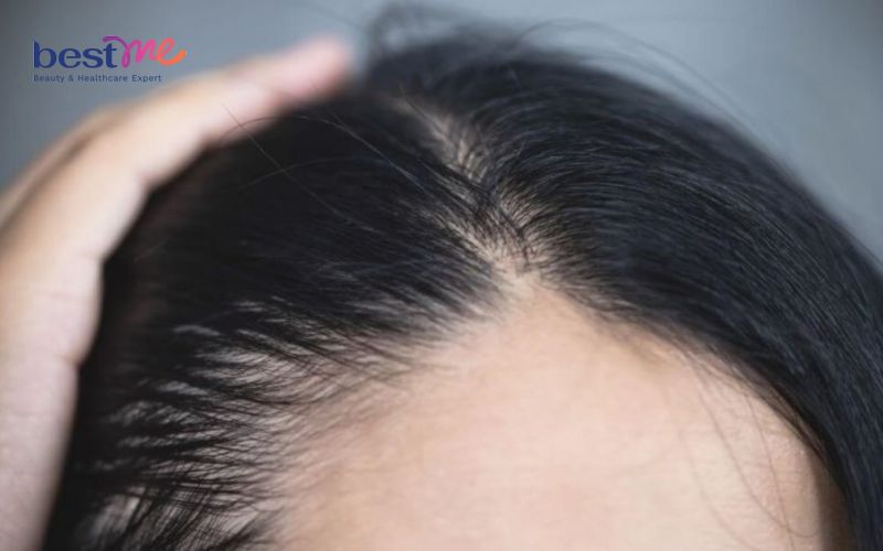 Nên ủ tóc mấy lần 1 tuần? Ủ tóc trước hay sau khi gội đầu? - 6