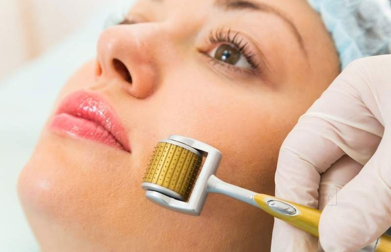 Một số lưu ý quan trọng giúp chăm sóc và bảo vệ da sau lăn kim