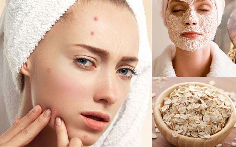 Mặt nạ dưỡng ẩm từ bột yến mạch còn giúp làm sạch mụn