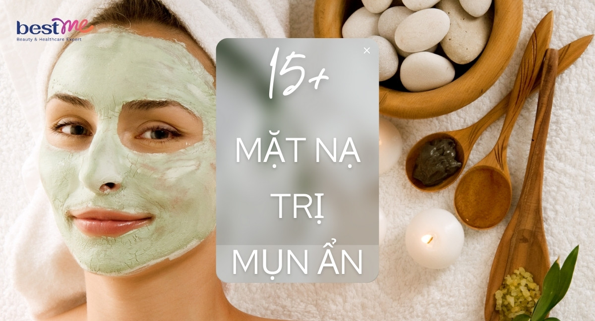 Gợi ý 15+ mặt nạ trị mụn ẩn an toàn, sạch bay mụn