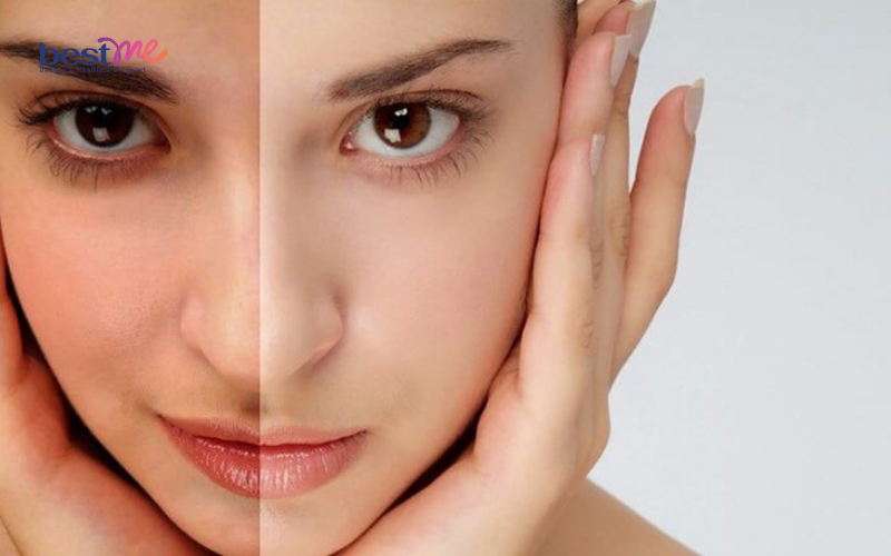 Ủ trắng da có nhiều ưu điểm