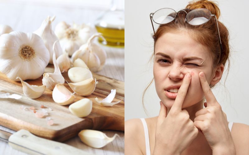 Khi sử dụng tỏi trị mụn bạn cần lưu ý không đắp quá lâu tránh gây bỏng da
