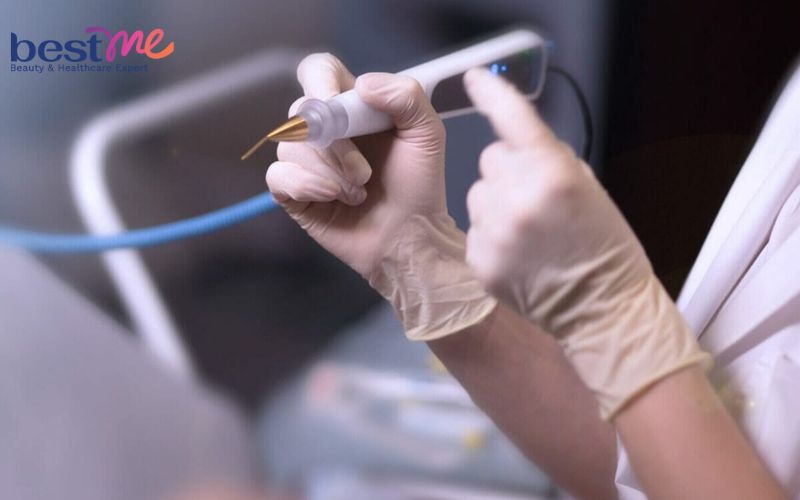 moc-mun-thit-o-mong-phai-lam-sao-cach-tri-hieu-qua-nhat-6 Mọc mụn thịt ở mông phải làm sao? Cách trị hiệu quả nhất - 6