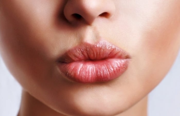 Mức độ thâm môi có thể đang phản ánh tình trạng sức khỏe của bạn