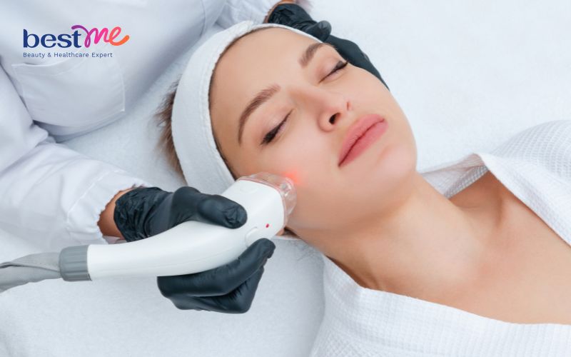 mun-an-duoi-cam-nguyen-nhan-va-cach-tri-hieu-qua-triet-de-4 Mụn ẩn dưới cằm: Nguyên nhân và cách trị hiệu quả triệt để - 4