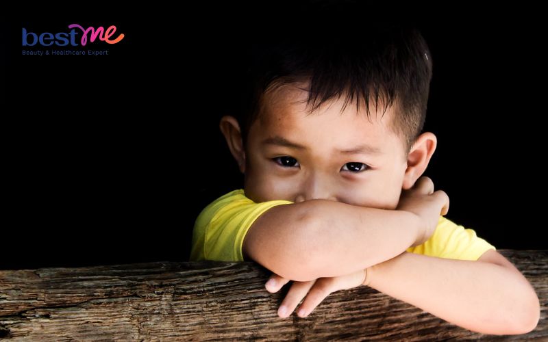 mun-nhot-o-dau-tre-em-nguoi-lon-nguyen-nhan-cach-dieu-tri-3 Mụn nhọt ở đầu trẻ em, người lớn: Nguyên nhân, cách điều trị - 3