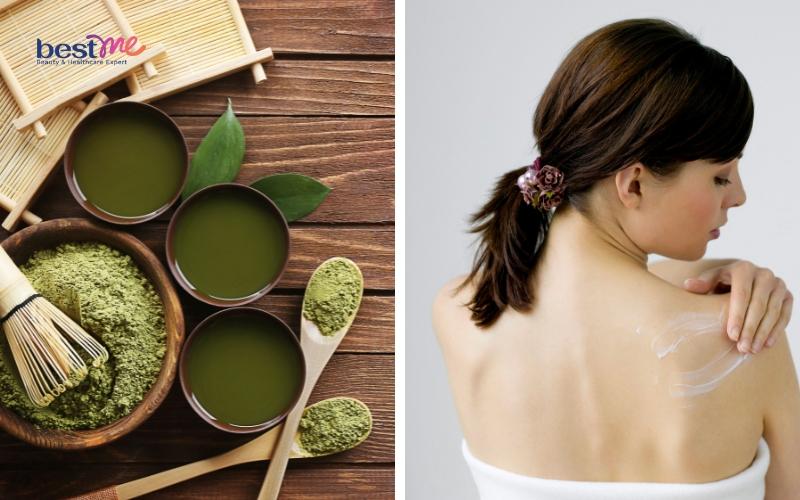 Mụn nhọt ở lưng có nguy hiểm không? Cách trị hiệu quả nhất? - 5