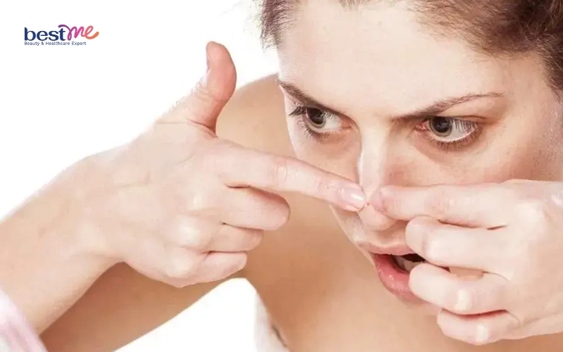 mun-nhot-o-mui-la-benh-gi-huong-dan-cach-dieu-tri-hieu-qua-6 Mụn nhọt ở mũi là bệnh gì? Hướng dẫn cách điều trị hiệu quả - 6