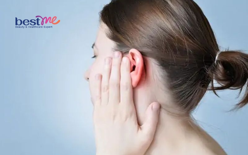 mun-u-ba-dau-la-gi-co-nguy-hiem-khong-co-tu-het-khong-5 Mụn u bã đậu là gì? Có nguy hiểm không? Có tự hết không? - 5