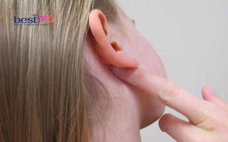 mun-u-ba-dau-o-tai-co-tu-het-khong-cach-tri-hieu-qua-nhat-5 Mụn u bã đậu ở tai có tự hết không? Cách trị hiệu quả nhất - 5