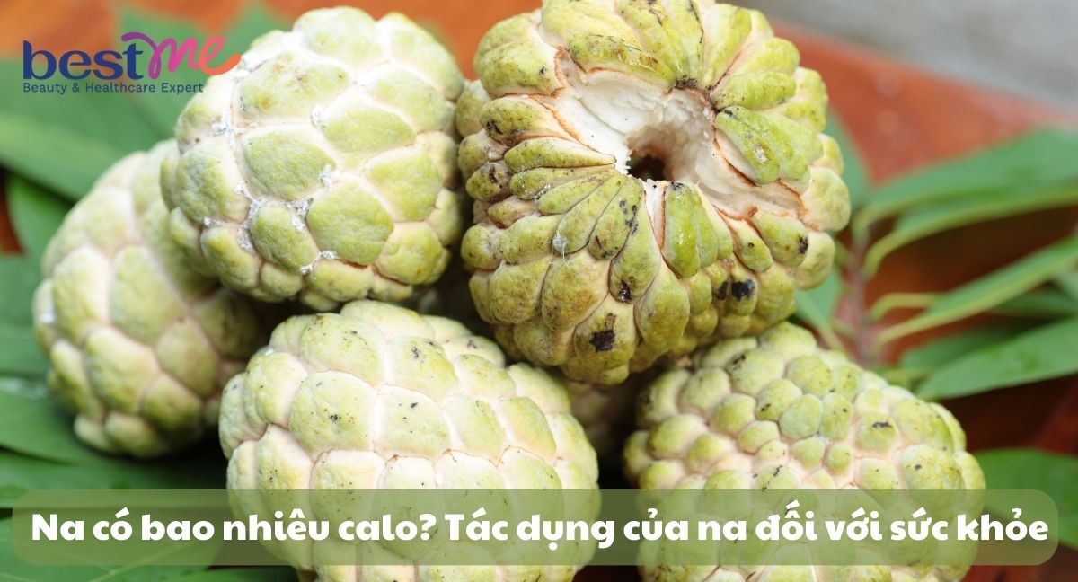 Tìm hiểu trong quả na có bao nhiêu calo? Tác dụng của na đối với sức khỏe