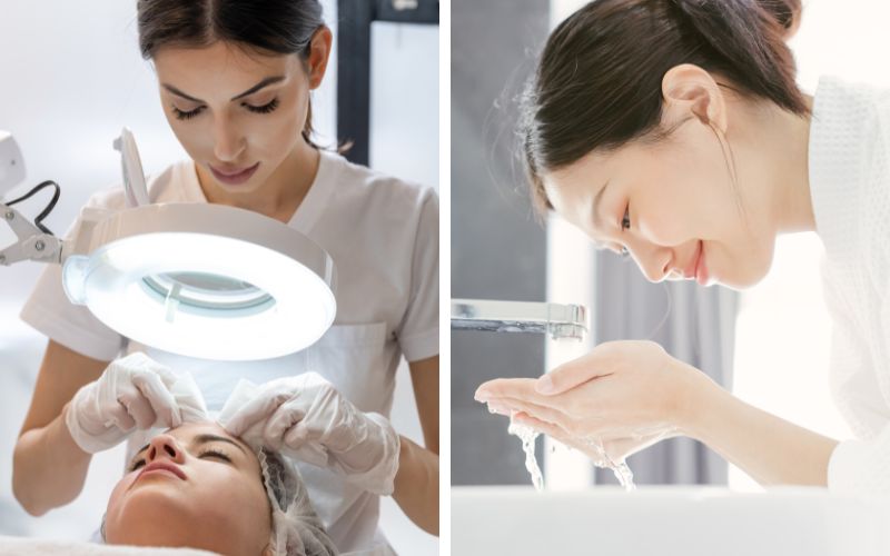 nan-mun-xong-co-nen-rua-mat-khong-nen-rua-mat-bang-gi-1 Nặn mụn xong có nên rửa mặt không? Nên rửa mặt bằng gì? - 1
