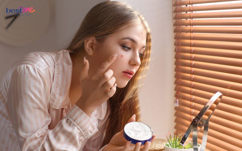 Nên bôi kem trị mụn trước hay sau dưỡng ẩm tốt, hiệu quả nhất? - 3