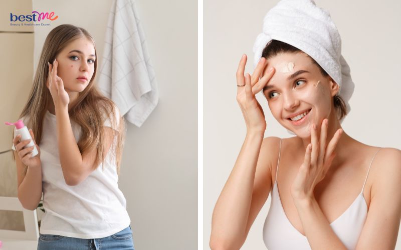 Nên bôi kem trị mụn trước hay sau dưỡng ẩm tốt, hiệu quả nhất? - 8