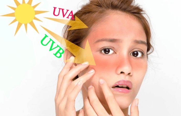 Cơ chế bảo vệ da của kem chống nắng hóa học
