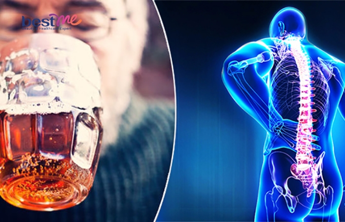 Lạm dụng bia rượu khiến khả năng hấp thụ canxi suy giảm