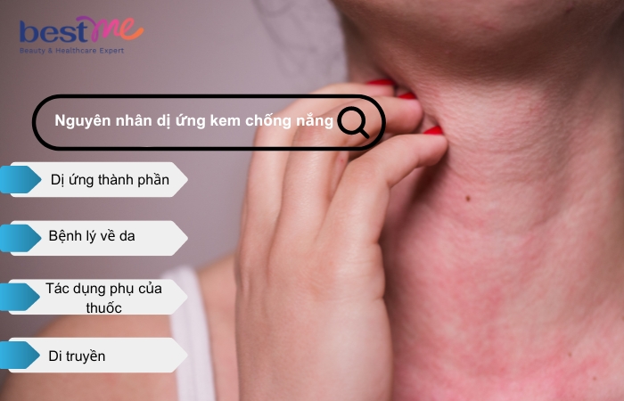 Nguyên nhân khiến da bị dị ứng kem chống nắng