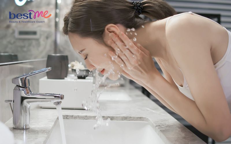nguyen-nhan-bi-mun-viem-do-o-ma-va-cach-dieu-tri-hieu-qua-3 Nguyên nhân bị mụn viêm đỏ ở má và cách điều trị hiệu quả - 3